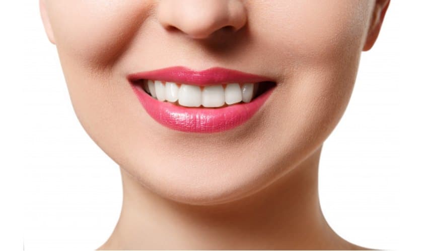 In-Office Teeth Whitening: The Benefits Over The-Counter Whitening Kits