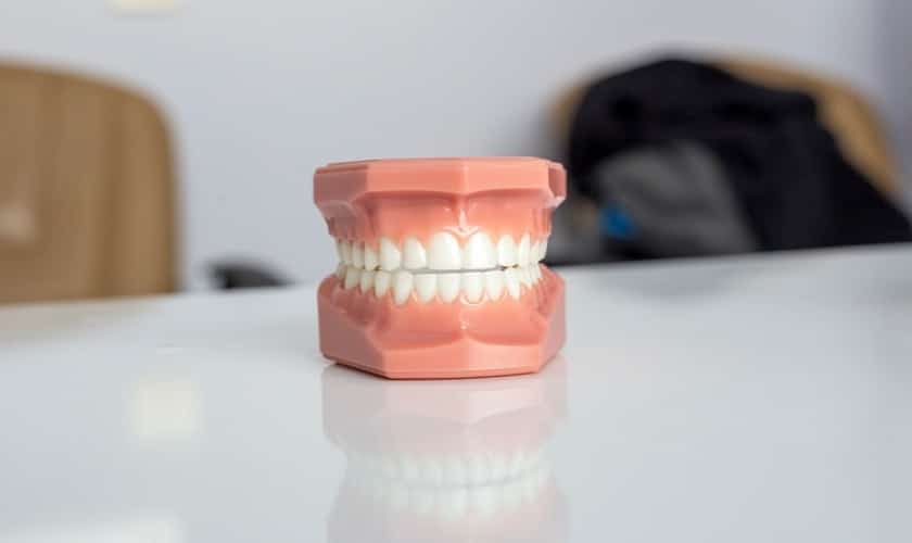 Teeth Cavities | Belmont Dentistry - Dentist Scottsdale AZ