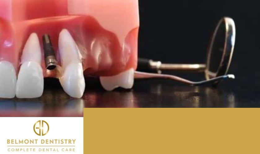 Can You Have Dental Implants With Bone Loss?