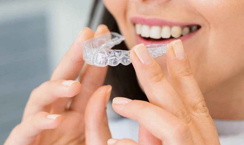 invisalign for gaps