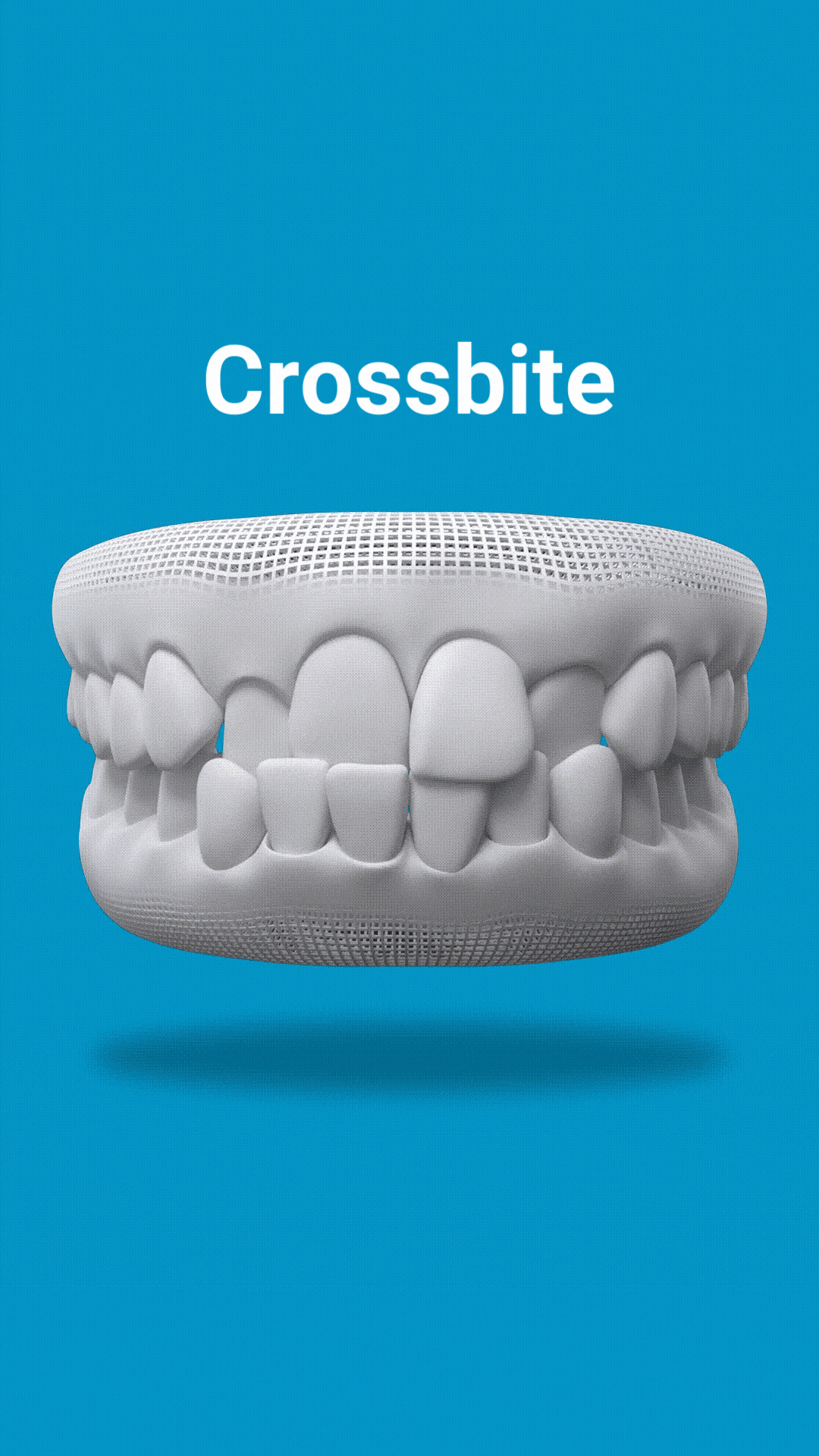 belmont dentistry scottsdale invisalign can fix dental crossbite issues