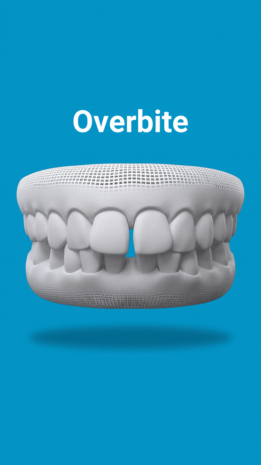 belmont dentistry scottsdale invisalign can fix dental overbite issues