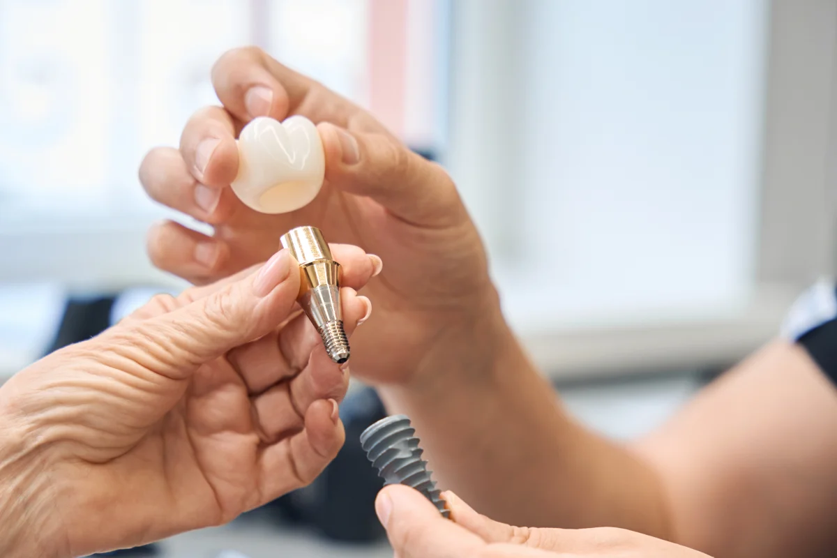 Restorative Options: The differences between fillings and dental crowns