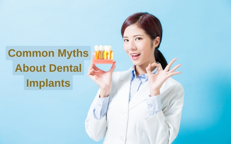 common myths about dental implants