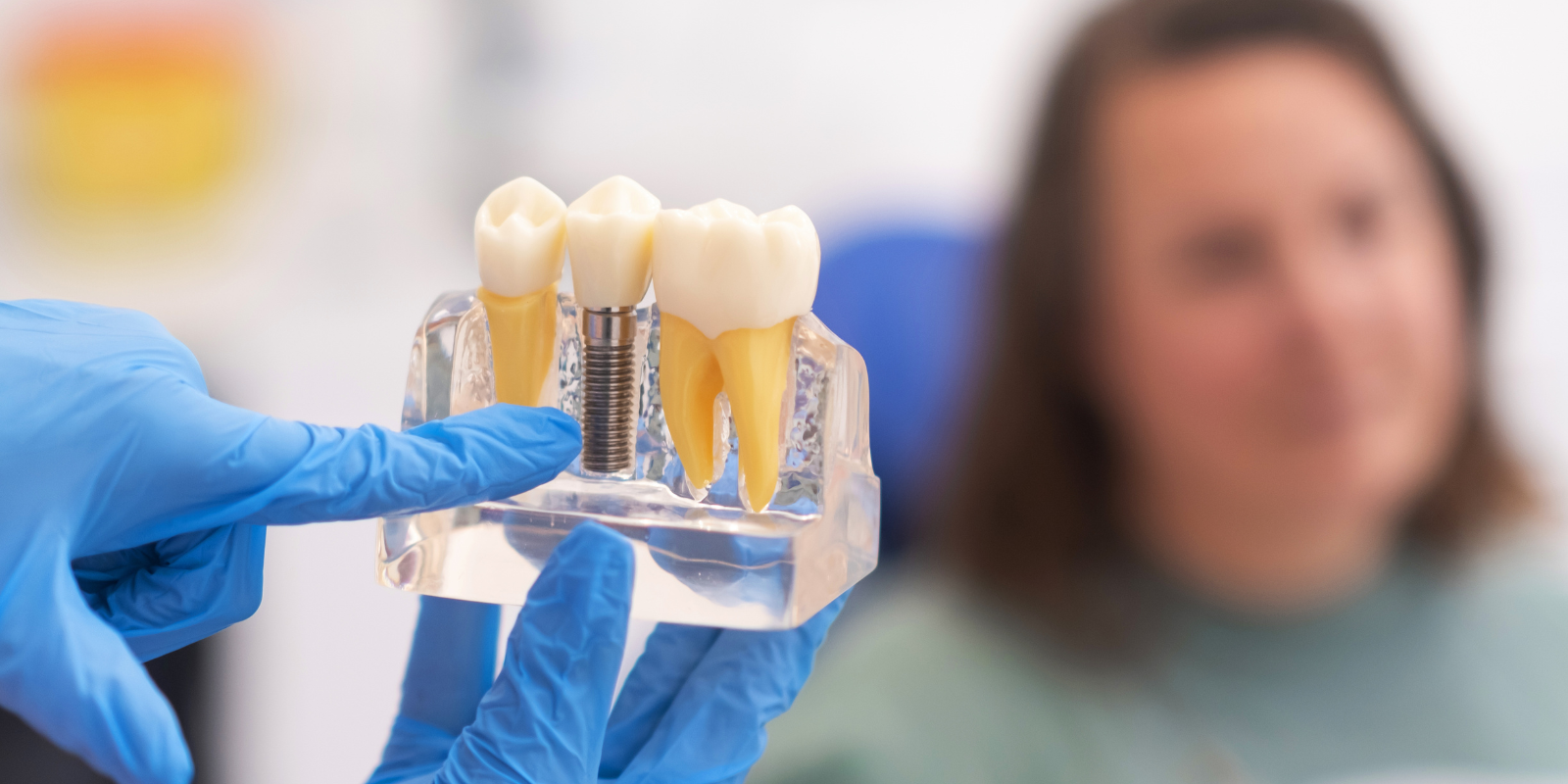 dental implants in scottsdale the most natural-looking tooth replacement