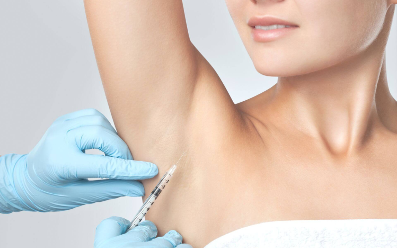 Botox Treatment For Excessive Sweating
