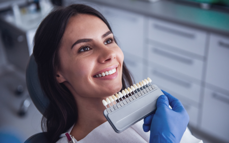 How long do veneers stay white