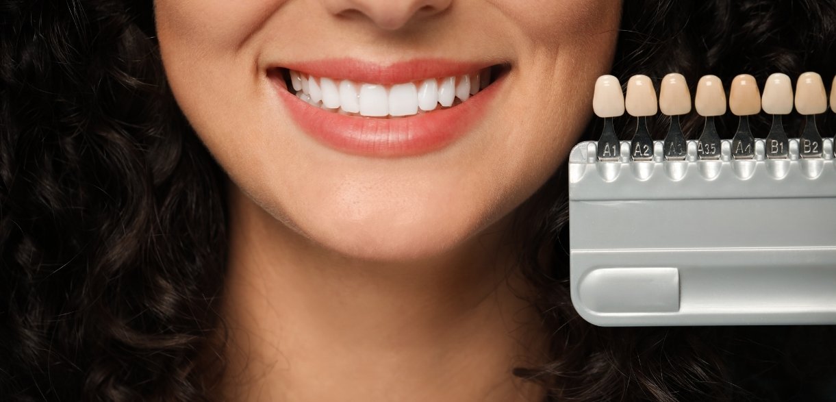 how porcelain veneers transform your smile instantly