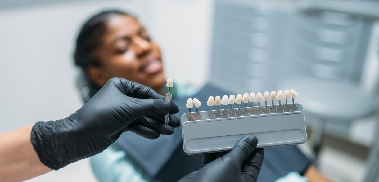 how veneers can subtly reshape your face