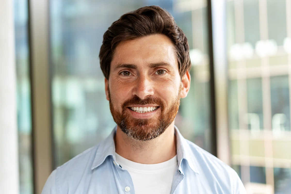 Professional Teeth Whitening in Paradise Valley: GLO System Results