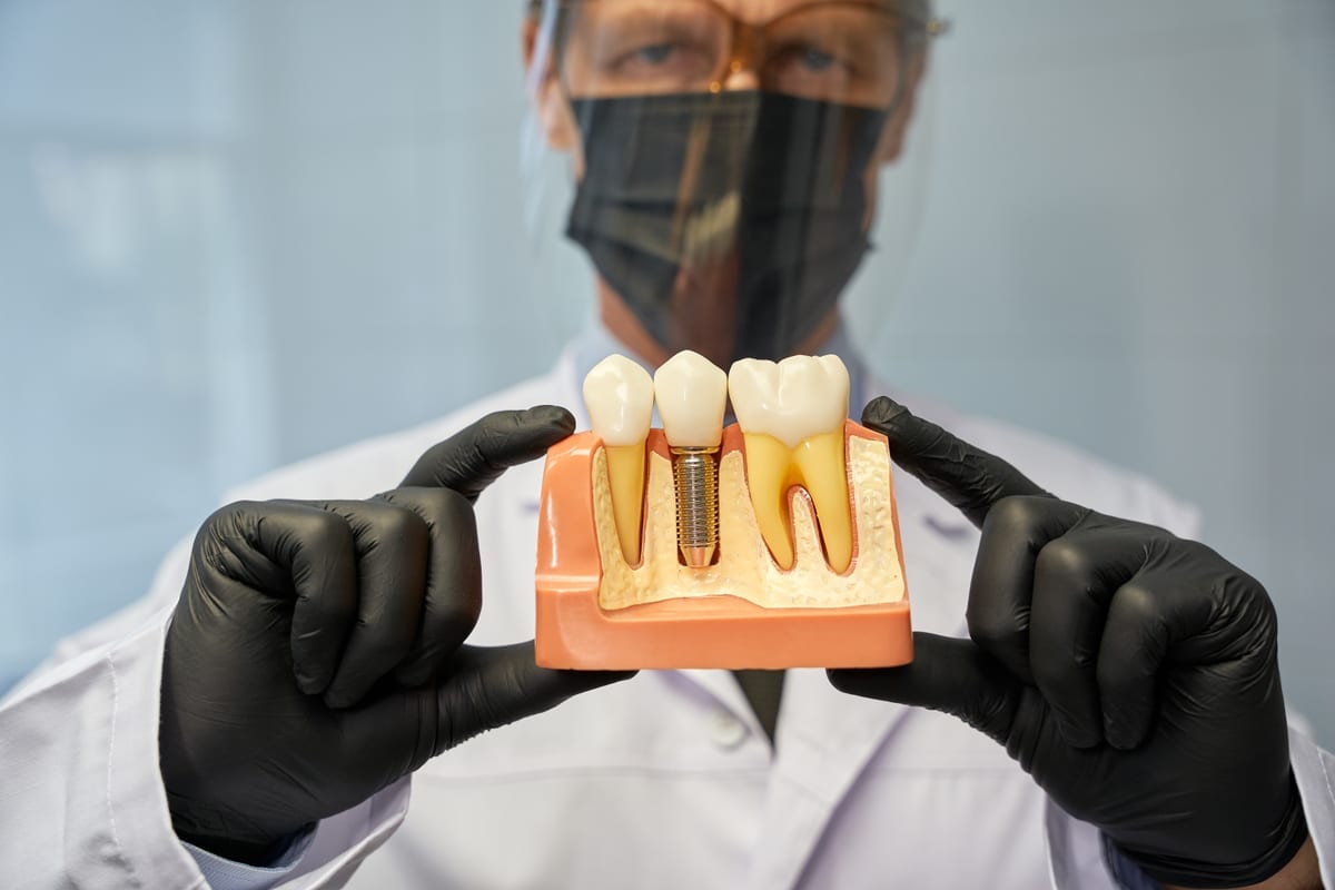Dental Implants in Youngtown