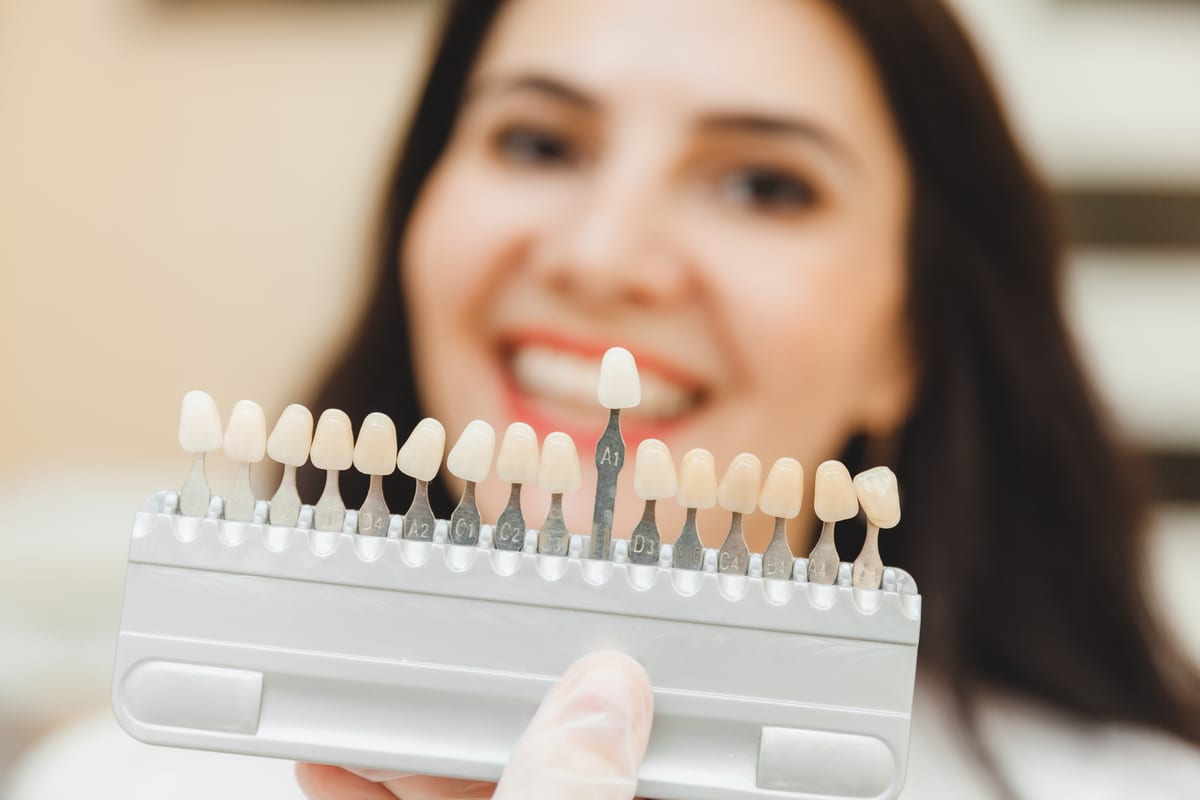 Veneers in Scottsdale
