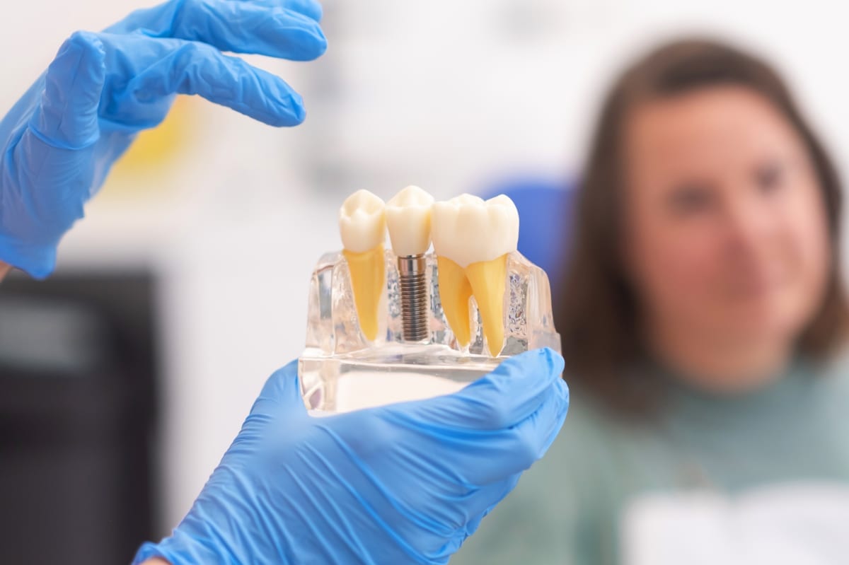 Dental Implants in Peoria