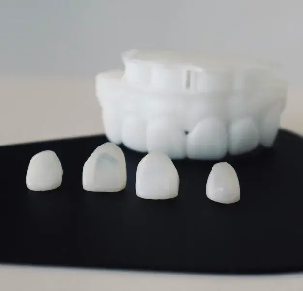 Dental veneers displayed on black surface showing shade options for tooth restoration.