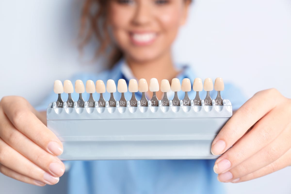 Veneers in Scottsdale